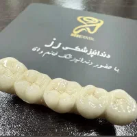 دندانپزشکی/زیبایی/ایمپلنت/روکش/مصنوعی