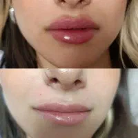 ژل وتاکس وسایر خدمات با نازلترین قیمت
