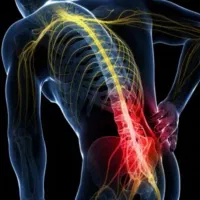 طوابت ودرمان دیسک کمر واختلالات عصبی