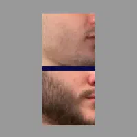 فیس جذاب داشته باش
