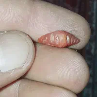 سنگ گردنی  قدمت دار