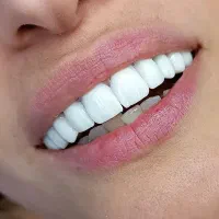 کامپوزیت دندان فکی ۵ میلیون با شرایط اقساط