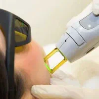 جشنواره تخفیفی   لیزر موهای زاید با کندلا شاتی