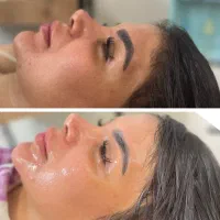 تخفیف فوق العاده (فیشال تخصصی پوست)