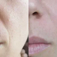 کرم جوانساز بیوممتیک اصل ایتالیایی