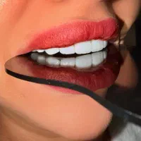 دندانپزشکی - ایمپلنت - کامپوزیت - عصب کشی