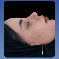 عمل های زیبایی