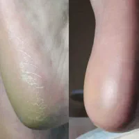 پدیکور و مانیکور پاهاتون رو به ما بسپارید