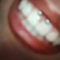 آموزش پیرسینگ