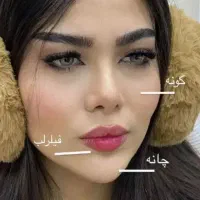 تخفیف ۳ روزه ژل و بوتاکس و پی ار پی
