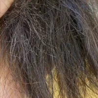 50 درصد تخفیف موخوره گیری روسی