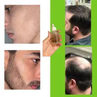چهره ای جذاب تر از همیشه داشته باش