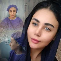 جراحی زیبایی بینی/مراجعه از فارسان به تهران/۴۳تومن