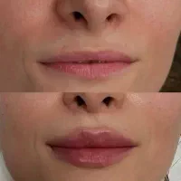 بهترین خدمات زیبایی ژل بوتاکس فیلر مزوژل لیزر|خدمات زیبایی و سلامت|شیراز, ارم|دیوار