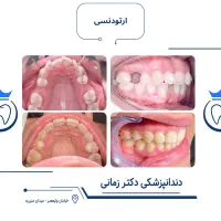 ارتودنسی نامرئی به روش دیجیتالی