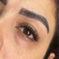 کاشت مژه هیدن ۲۰۰