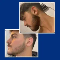 تیغ نزن در نمیاد
