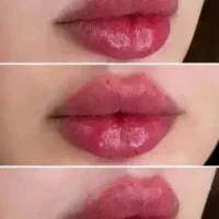 ژل لب
