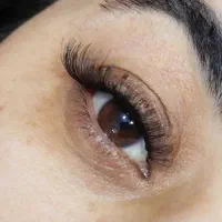 کاشت مژه