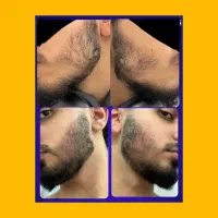رویـش ریش و سیبیل