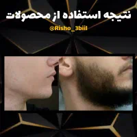 جذابیتو به چهرت برگردون