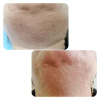 الکترولیز بانوان (رفع دائمی موهای زائد صورت و بدن)|خدمات آرایشگری و زیبایی|شیراز, گویم|دیوار