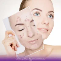 فیشال تخصصی پوست