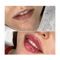 لیزر فیلر بوتاکس لاغری کلینیک فرهنگیان