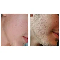 مرد شو|آرایشی، بهداشتی، درمانی|شوشتر, |دیوار