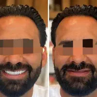 دندان مصنوعی، دست دندان،تعمیرات،دندانسازی