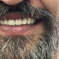 لابراتور دندانسازی