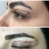 خدمات لیفت ، جوانسازی و زیبایی