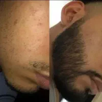 تغییر اساسی چهره