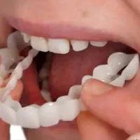 داندانپزشکی و دندانسازی پروتز