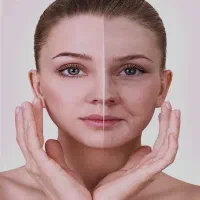 تزریق ژل بوتاکس فیلر