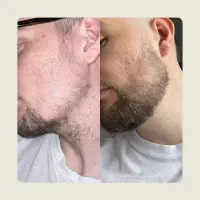 فقط با ریش و سبیل ۲ برابر جذاب میشی