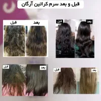 محصولات مراقبتی درمانی پوست و مو تراست