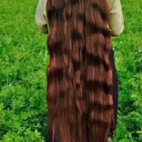 مرکز اصلی مو