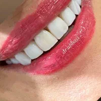 دستیار دندانپزشک