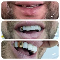 ارائه خدمات دندانپزشکی(کاریزما)