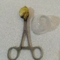 آموزش طب سوزنی و سنتی زیر نظر دکتری طب