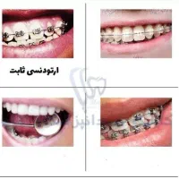 ارتودنسی کوتاه مدت کمترین هزینه