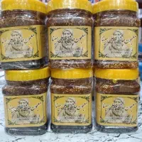 چاقی کل اندام