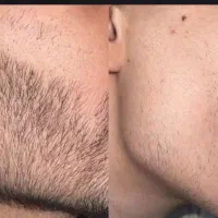 اگه میخای دیگه اذیتت نکنن بیا