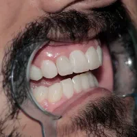 کامپوزیت*لمینیت از دم قسط