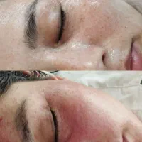 حذف لک فقط و فقط در یک جلسه