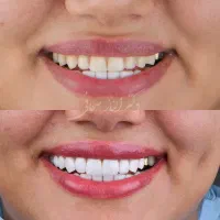 دندانپزشکی شهرقدس(بیمه تکمیلی آنلاین) اقساطی