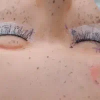 کاشت مژه