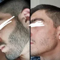 اَز ریشِه حَلِش کُن