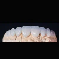 لابراتوار دندانسازی ثابت